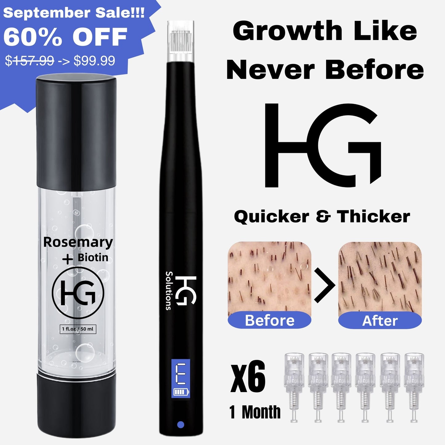 Hair-Gen Growth Kit